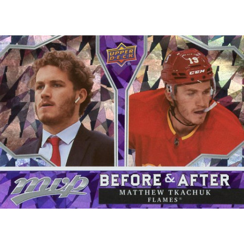 MATTHEW TKACHUK insert 21-22 UD MVP Before and After